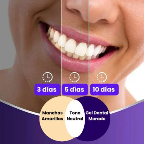 Hismile™ - Crema Dental Blanqueadora 30ml