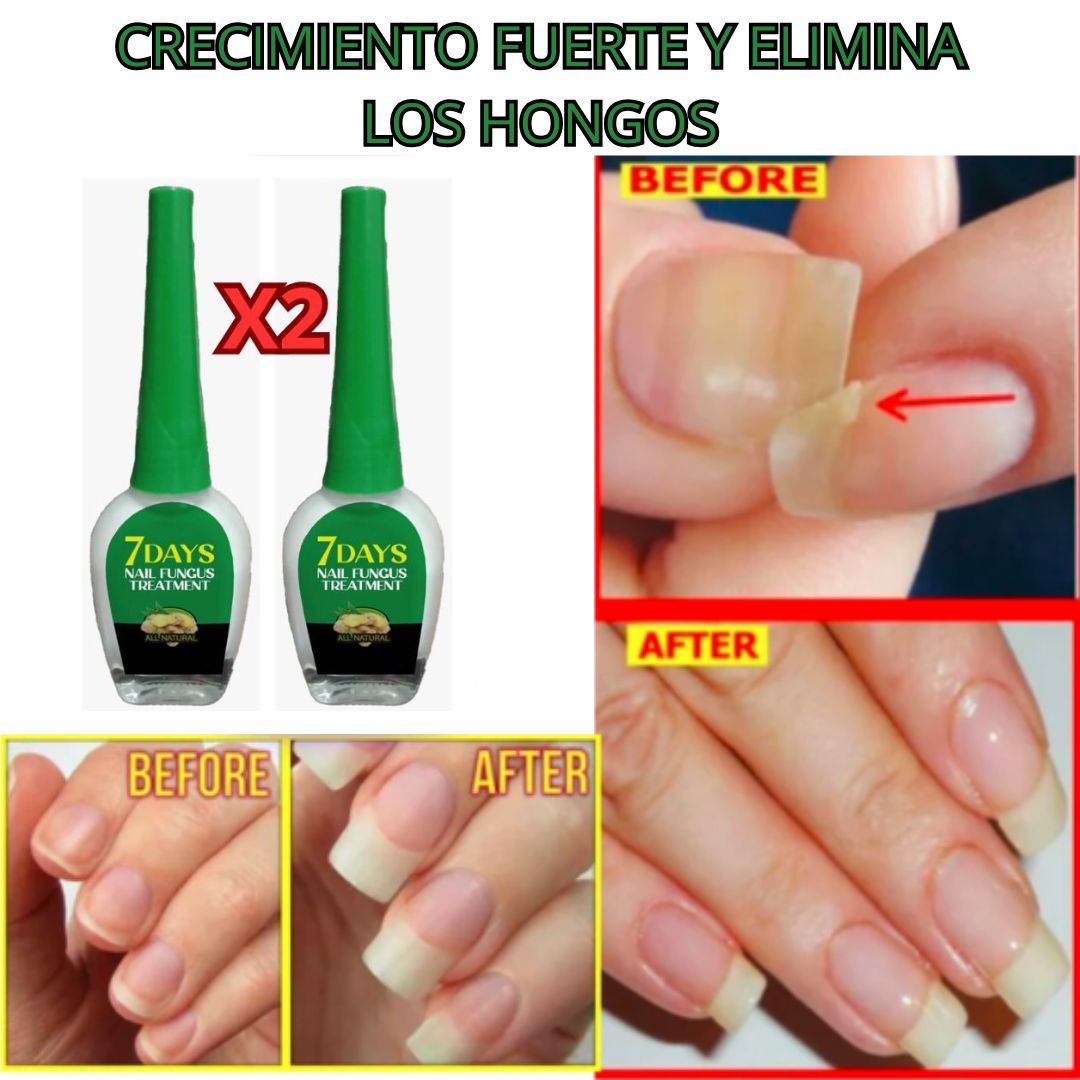 Serum Reparador, Estimulador de Crecimiento y Eliminador de Hongos (2X1🎁)