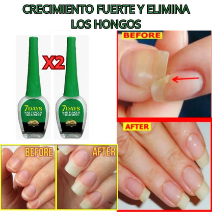 Serum Reparador, Estimulador de Crecimiento y Eliminador de Hongos (2X1🎁)